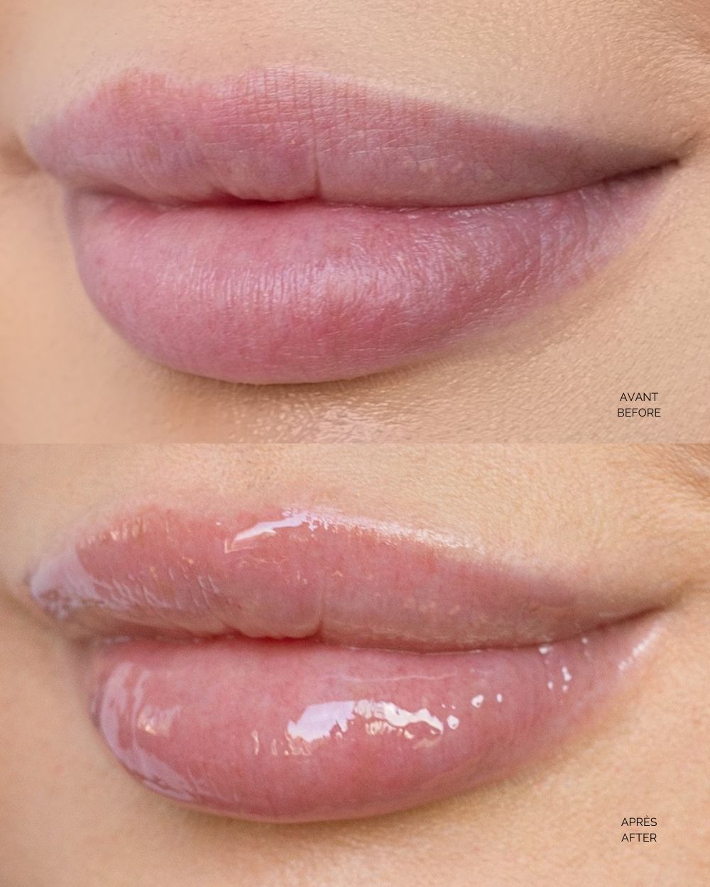 Spring Essentials Lip Oil Bundle